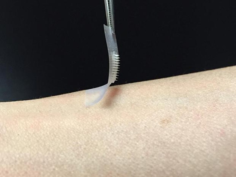 diabetes-insulin-smart-patch
