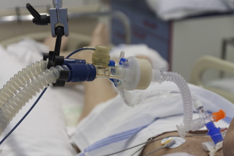Coronavirus ICU Patient