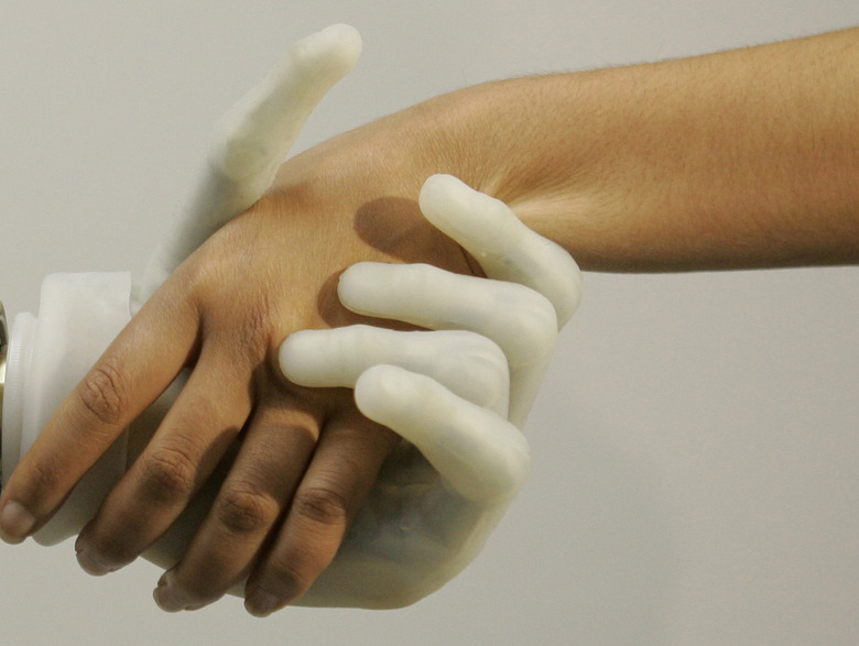 prosthetic hand