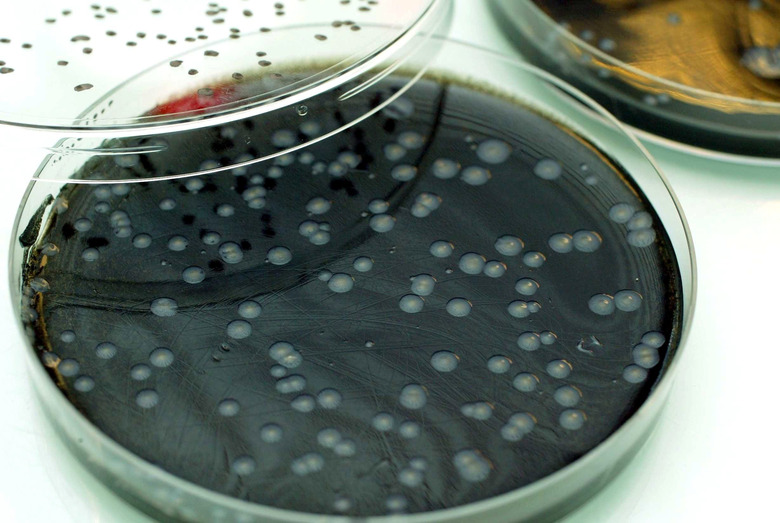 LEGIONELLA COLONIES AT THE PASTEUR INSTITUTE, LILLE, FRANCE - 09 JAN 2004