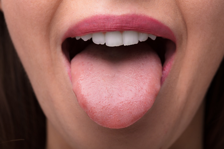 tongue