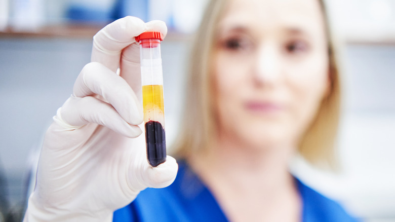 blood vial in hospital