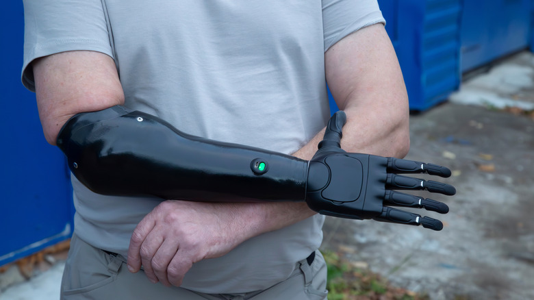 A person controlling a black prosthetic arm