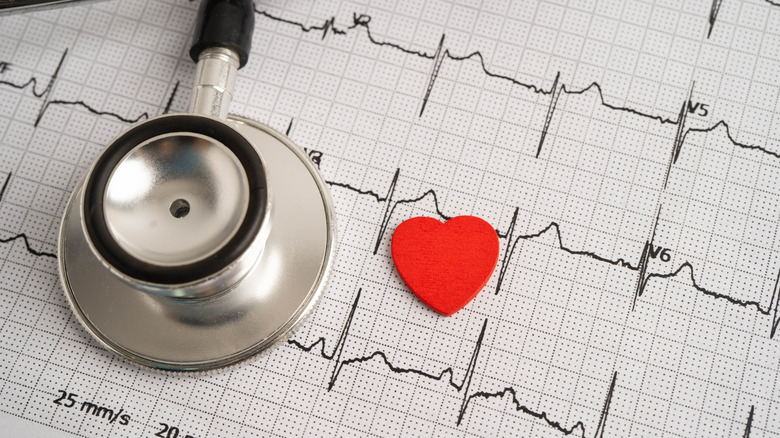 A stethoscope lying beside a small heart cutout on top of a paper showing heartbeat graphs