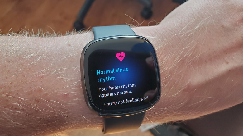 Fitbit Sense smartwatch on a wrist, showing ECG heart health function