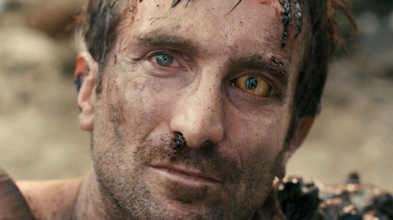 Wikus smiling with two different eye colors in 