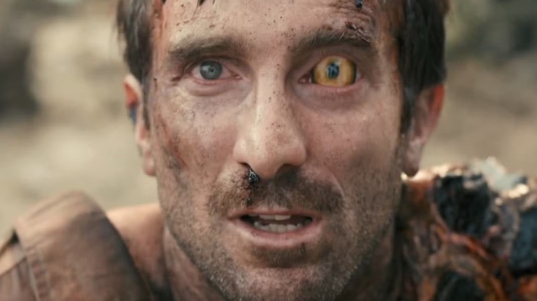 Wikus van de Merwe in District 9 with an alien eye
