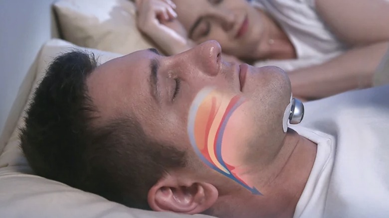 A man sleeps comfortably with the Snore Circle device attached to the underside of his chin