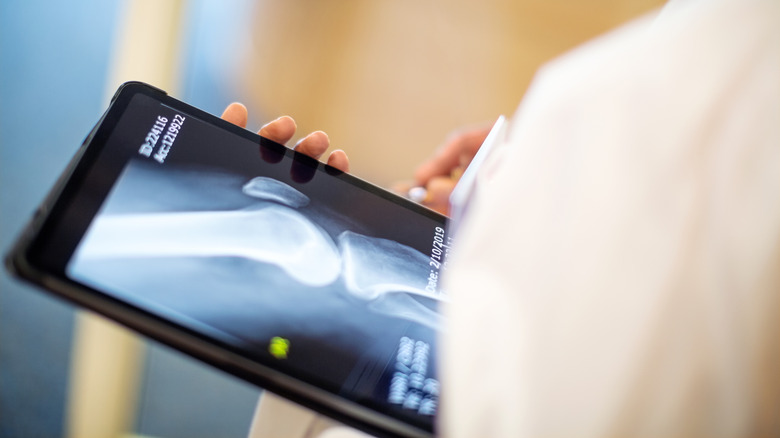 Medical X-ray of patient visible on tablet held by physician.