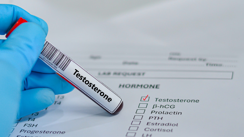 A person holds a blood test tube labelled "testosterone"