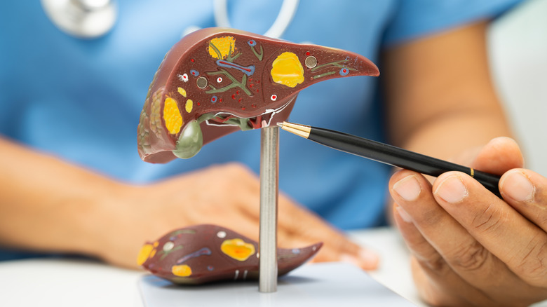 Doctor displaying liver anatomy
