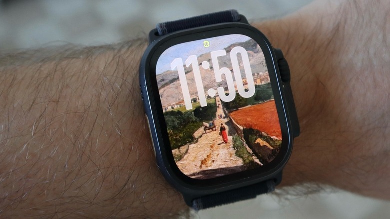 Apple Watch on the wrist with watchOS 26's new Photos Watch Face