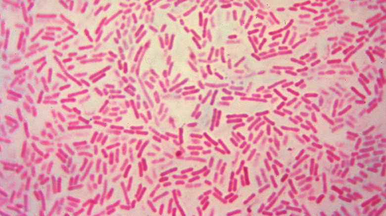 Bacteroides anaerobic bacteria under microscope