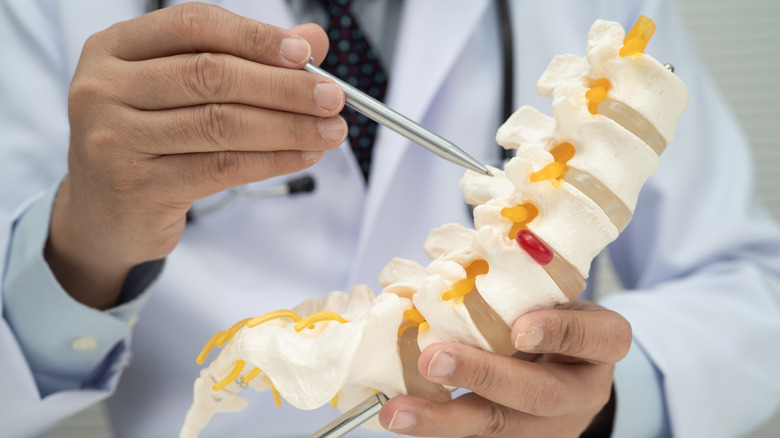 A doctor using a pen to point at a model of the spine.