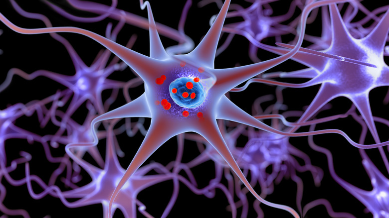 3D illustration of Lewy bodies in the brain's neurons from Parkinson's.