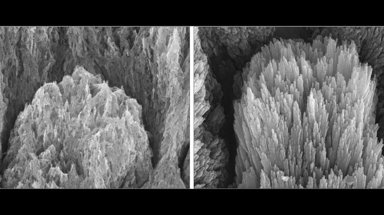 A side-by-side electron microscopy photograph shows how Epinamel regenerates enamel crystals in just two weeks.