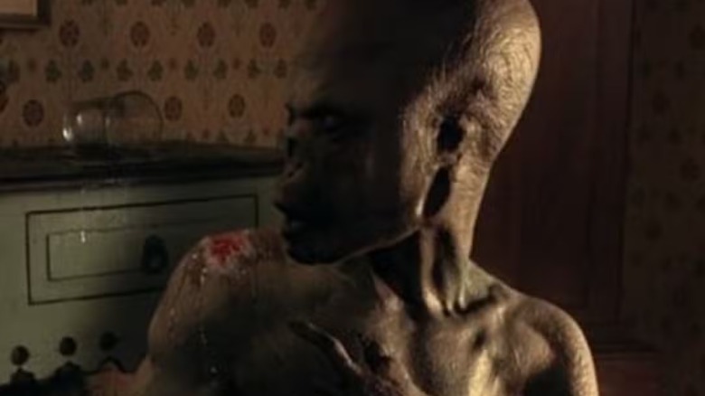 Signs alien looking at burnt shoulder