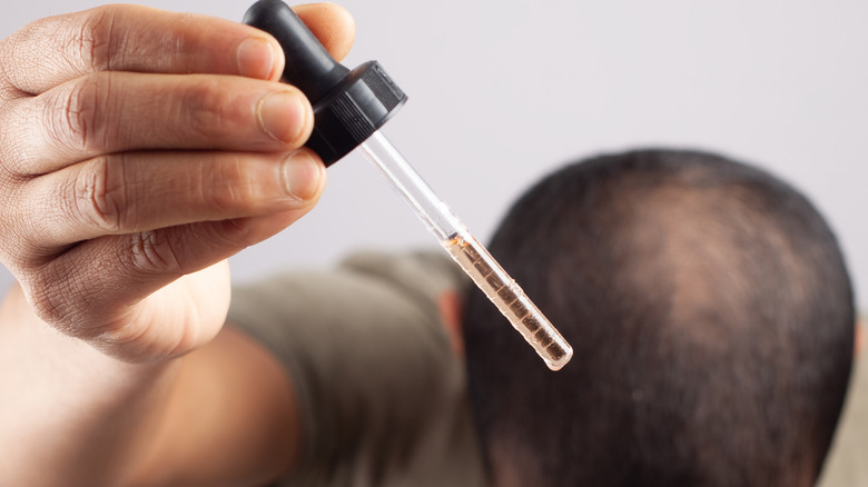 Man using medication to treat going bald
